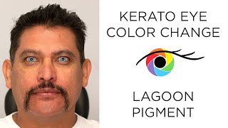 Eye Color Change from Brown to Light Blue Lagoon pigment [upl. by Ardnuek]