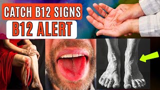 How to Spot Vitamin B12 Deficiency Before Its Too Late [upl. by Licna22]