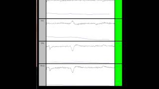 BrainAvatar Muse EEG [upl. by Schiro]