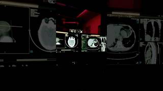 CT scan 128slice new freefire sad neet sorts trending sosalmidia radiology [upl. by Hploda764]