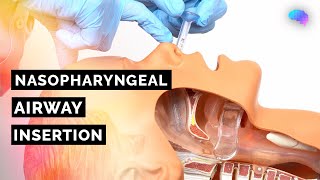 Nasopharyngeal Airway NPA Insertion  ABCDE Emergency  OSCE Guide  UKMLA  CPSA [upl. by Revilo]