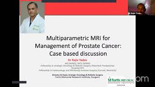 Multiparametric MRI For Management of Prostate Cancer  Case Based Discussion  Urology  MRI [upl. by Ahsitneuq]