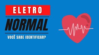 Saiba olhar um ECG normal [upl. by Eben402]