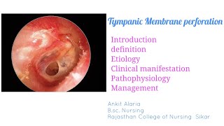 Tympanic Membrane perforation [upl. by Whallon715]