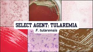 Morphology Moments  Tularemia [upl. by Ruth]