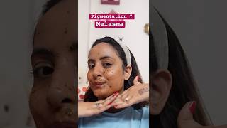 Melasma Treatment  Pigmentation Cure  Apply this homemade mask pigmentation youtubeshorts [upl. by Yenterb]