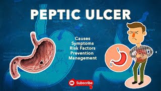 HOW TO know if you have STOMACHPEPTIC ULCER DISEASE😱🔥 [upl. by Willow]