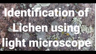 Identification of Lichen using Light microscope [upl. by Harrod]