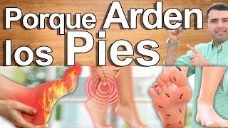 Porqué Me Arden Los Pies  Causas Y Soluciones Para El Ardor Y Dolor En Los Pies [upl. by Keiko822]