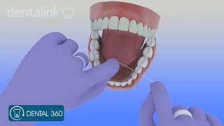 Uso del hilo dental cepillo interdental y limpiador de lengua  Dental 360 [upl. by Em650]