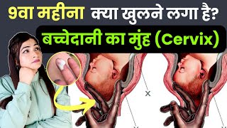 9वें महीने में खुलने लगा है बच्चेदानी का मुंह l Symptoms of Cervix Opening [upl. by Ramraj]