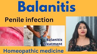 Balanitis penile infection treatment  Balanitis symptomscauses amp homeopathic medicine in hindi [upl. by Bannerman882]