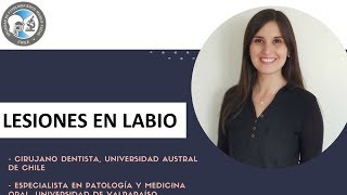 Patología Oral Jornada San Felipe presentación Dra Verónica Peña y Lillo junio 2018 [upl. by Jaine204]