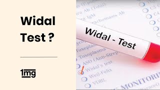 How is Widal Test done for Typhoid Fever  1mg [upl. by Nauh]