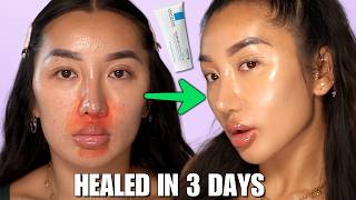 HOW I HEALED MY SKIN USING KBEAUTY 😍 REPAIR YOUR SKIN BARRIER [upl. by Ymor]