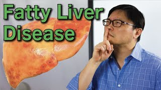 How to Reverse Fatty Liver Disease Naturally  Jason Fung [upl. by Otsirave443]