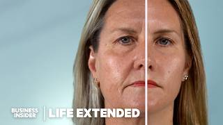 Scientists Are Closer Than Ever To Reverse Aging How Does It Work  Life Extended [upl. by Somar624]