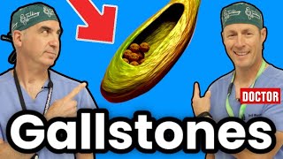 How To Get Rid Of Gallstones And Cholecystitis [upl. by Elatia]