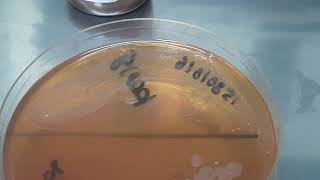 Serratia mercescens growth on broth  Bactec vial and MacConkey agar  Neonatal sepsis [upl. by Dnomra]