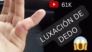 Reducción de Luxación de dedo shorts juancalbornoz luxación [upl. by Lenrow772]