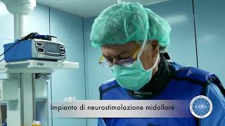 Neurostimolazione per dolore cronico schiena e gambe [upl. by Neelon]