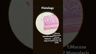 ANATOMY  HISTOLOGY  JEJUNUM  IDENTIFICATION FEATURES mbbs anatomy histology medstudent [upl. by Nannaihr]