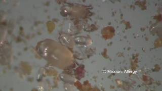 Dust Mites under the Microscope in HiDefmov [upl. by Marlyn55]