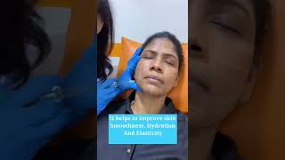 Hydrating the face with Juvederm Volite juvederm skinbooster skinboosters aestheticdermatology [upl. by Crissie]