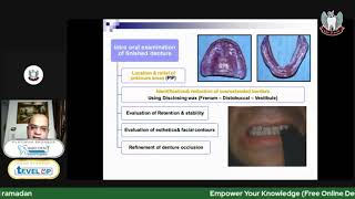 Complete denture insertion Part 2 Intraoral examination of finished denture [upl. by Hujsak]