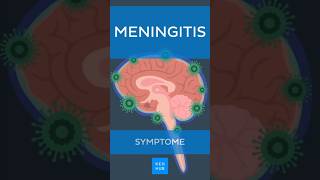 Meningitis Hirnhautentzündung Symptome  Kenhub meningitis [upl. by Sonitnatsnoc]