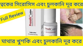 Prosalic Lotion Betamethasone Salicylic Acid মাথার খুশকি দূর করার ঔষধ সম্পর্কে বিস্তারিত আলোচনা [upl. by Ardnahcal]