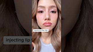 Review of injecting lip filler myself with 1CC [upl. by Colley]