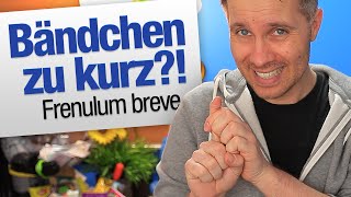 Zu kurzes Bändchen Frenulum breve  jungsfragende [upl. by Asikal]