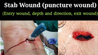 Stab wound  Forensic medicine inquiries  Forensic science [upl. by Avir]