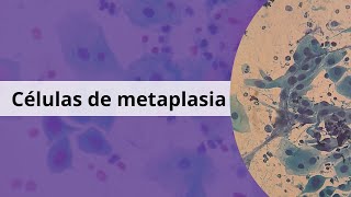 Metaplasia ¿Qué significa [upl. by Vachil534]