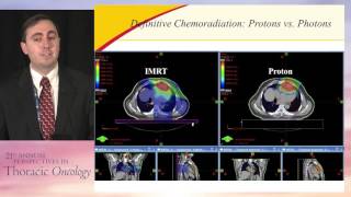 Novel forms of radiation IMRT proton beam or SBRT in LANSC [upl. by Ylebmik518]