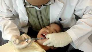 Root Canal of a 4year old [upl. by Arzed]