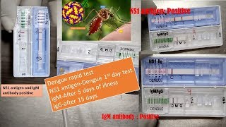 Dengue NS1 antigen positive IgM positive and IgG positive and significances in dengue fever [upl. by Sisely]