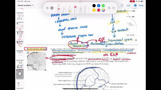 Dural venous sinuses anatomy and physiology neurology 43  First Aid USMLE Step 1 in UrduHindi [upl. by Loux293]