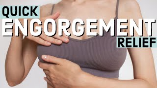 HOW TO RELIEVE ENGORGEMENT [upl. by Neirual]