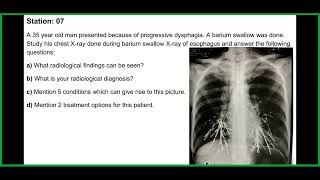 FCPS Mid Term Medicine Last Session BCPS OSCE Solve July24 [upl. by Rhines]