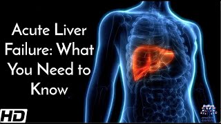 Acute Liver Failure What You Need To Know [upl. by Bruckner]