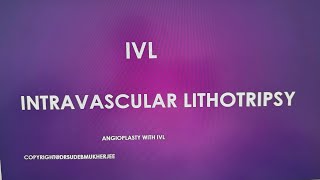 IVL Intravascular Lithotripsy ANGIOPLASTY Complex PTCA [upl. by Ateekan]