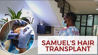 Vinci Hair Clinic Africa Samuels Hair Transplant [upl. by Marozik]