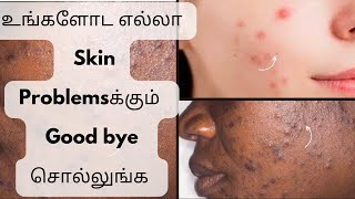 இந்த face pack try பண்ணிட்டு எப்படி இருக்குனு சொல்லமாடிங்க தெரியாம போச்சேன்னு ஃபீல் பண்ணுவீங்க [upl. by Beryl]