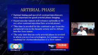 CT and MRI of liver lesions by Dr Raghu G [upl. by Saqaw]