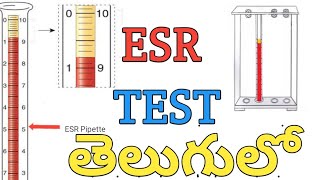 ESR Test procedureIn Teluguerythrocyte sedimentation rate [upl. by Balcke]