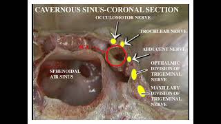 Sphenoid Bone [upl. by Phippen]