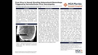 From Virus to Vessel Subarachnoid Hemorrhage Triggered by VaricellaZoster Virus Vasculopathy [upl. by Olivier]