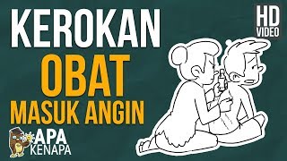 Kerokan Untuk Menghilangkan Masuk Angin Mitos Atau Fakta  ApaKenapa [upl. by Ervin]